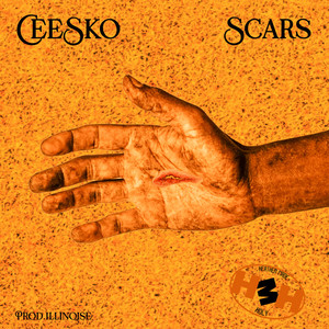 Scars