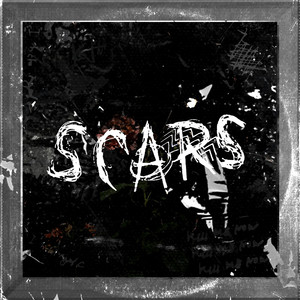 Scars