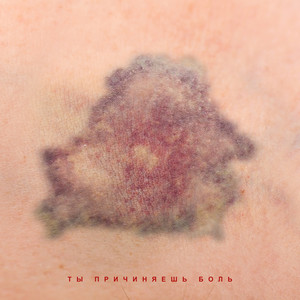 Ты причиняешь боль