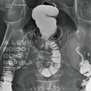 Registros (Explicit)