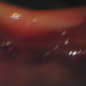 TE AMEI TE AMEI (Remix)