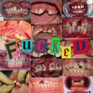 F U C K E D (Explicit)