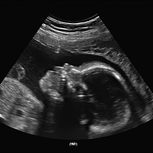 WHAT WE DO (feat. ONE7FLEXX) (Explicit)