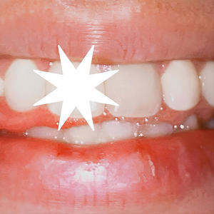 miraME (feat. bandeja)