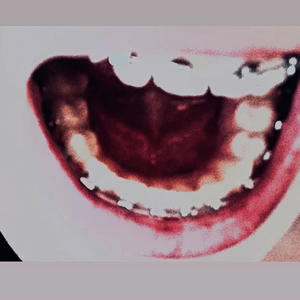 stomach bug (Explicit)