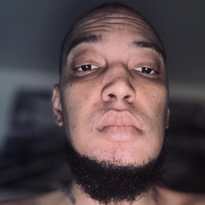 Stage 4 Cancer Flow (Explicit)