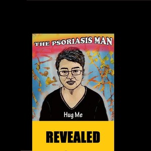 The Psoriasis Man: Revealed