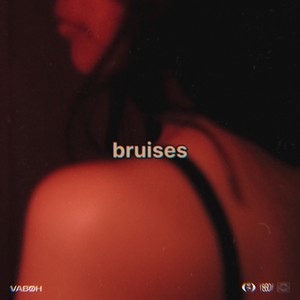 Bruises