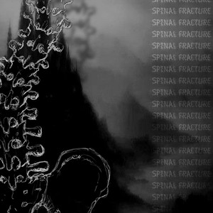 spinal Fracture (Explicit)