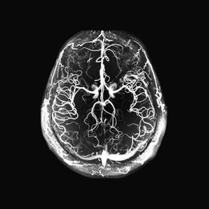 die like this (feat. whiterosemoxie) (Explicit)