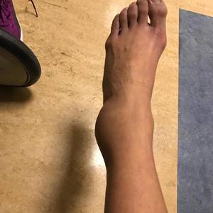 DUCK NECK!!!! (Explicit)