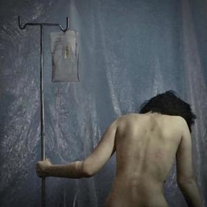 Patient 58