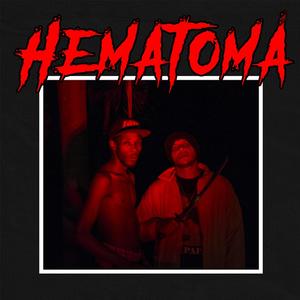 Hematoma