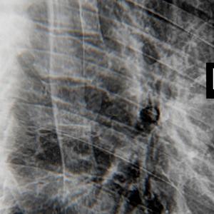 Human Volcano (Bush Mix)