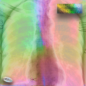 Lungencheck (Explicit)