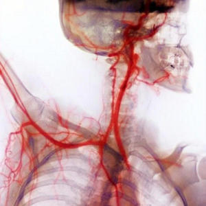 Bloodstream (Explicit)