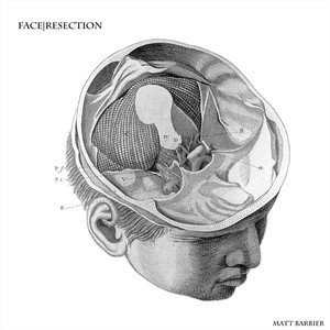 Face|Resection