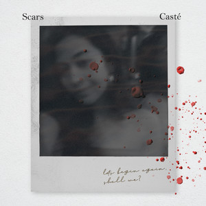 Scars