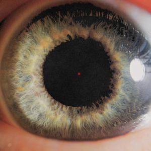 Yüksek Doz (Explicit)