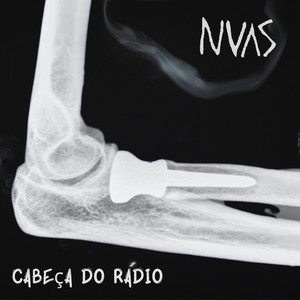 Cabeça do Rádio