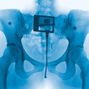 Hammer (Explicit)