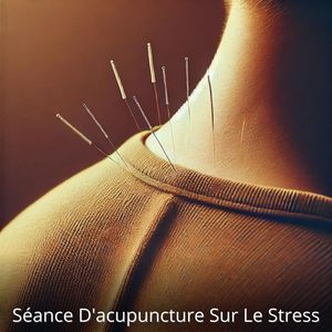 Séance d'acupuncture sur le stress