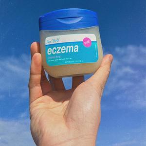 Eczema