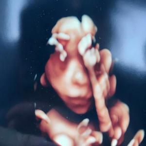 YENİ DÜNYA AŞK İLE BAŞLAYACAK (feat. Volkan İncüvez) (Explicit)