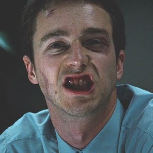 Broken Teeth (Prod. swirl)