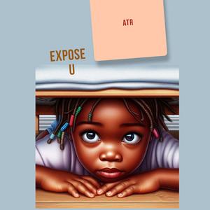 Expose U (Explicit)