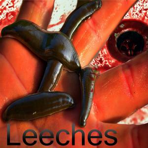 Leeches