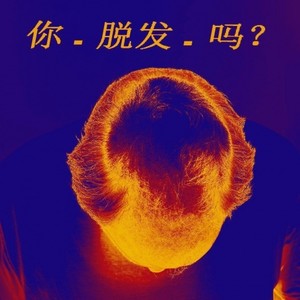 你脱发吗？