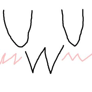 I Also Hate My Dad (Let's Get Married)