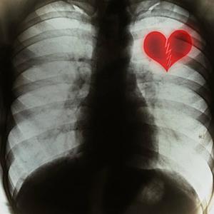 Hier Gan Ons Alweer (feat. SparkzTheKid) (Explicit)