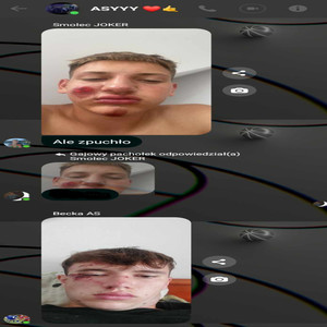 Dziary na twarzy (Explicit)