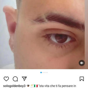 Nervi sensibili (Explicit)