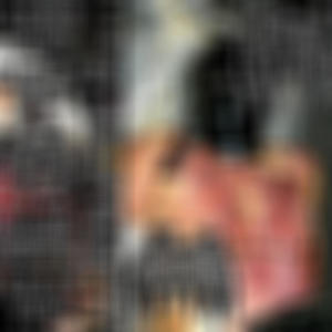 Gangrenous Carcass Completely Covered In Epidermal Cyst, Leaving No Visible Epidermis, Pt. 2 (Explicit)