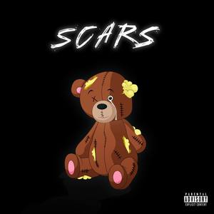 Scars