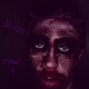 bruise (Explicit)