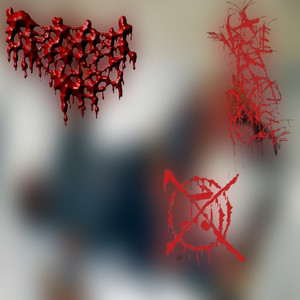 AxBxCxNxGx 3rd Degree Burns