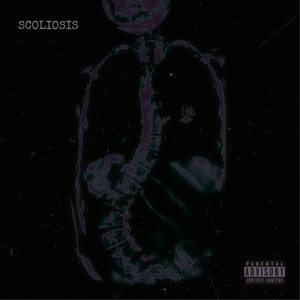 Scoliosis (Explicit)