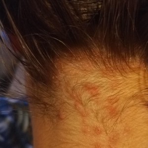 Phobie Scolaire (Explicit)