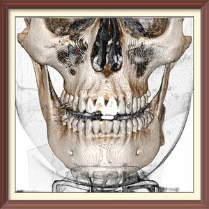 Jinnss - Scandal (Explicit)