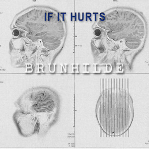 If It Hurts