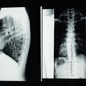 Spine Curve