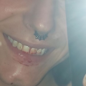 NECROASPHYXIATION (Explicit)