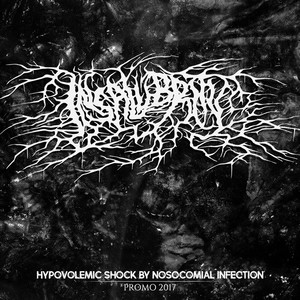 Hypovolemic Shock by Nosocomial Infection