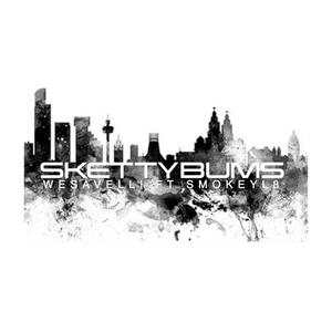 Sketty Bums (feat. SmokeyL8) [Explicit]