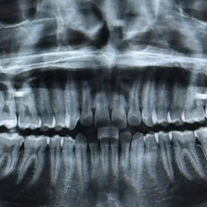 LOVE/LUST (feat. ****edUpKidsKult & Prince Exid) (Explicit)