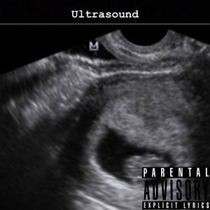 Ultrasound